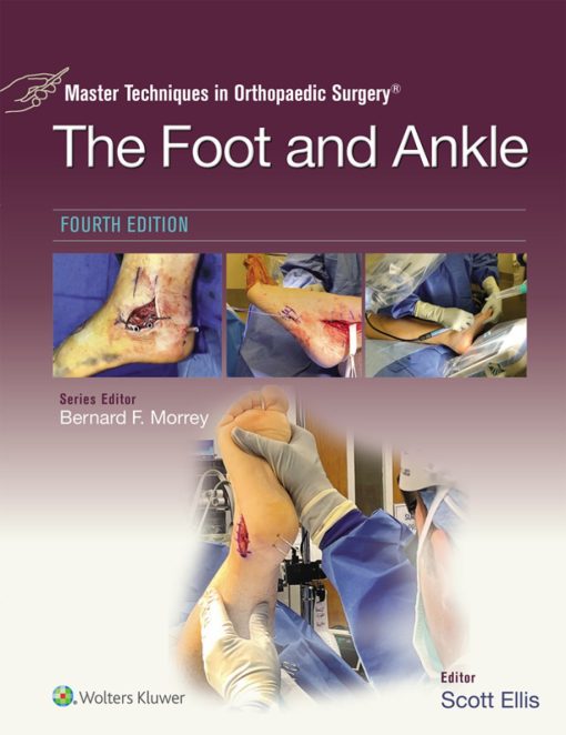 Master Techniques in Orthopaedic Surgery: The Foot and Ankle, 4th Edition EPUB