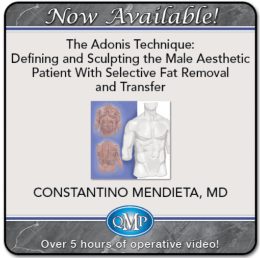 QMP The Adonis Technique Defining and Sculpting the Male Aesthetic Patient With Selective Fat Removal and Transfer 2025