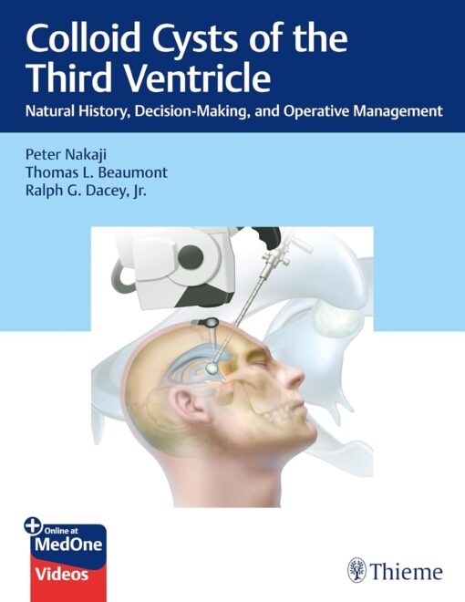 Colloid Cysts of the Third Ventricle: Natural History, Decision-Making, and Operative Management 1st Edition PDF AND VIDEO 