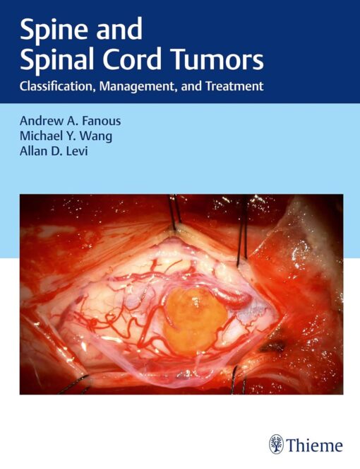Spine and Spinal Cord Tumors: Classification, Management, and Treatment (Original PDF from Publisher)